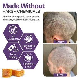 Shailee Psoriasis Shampoo 240g side view with product label