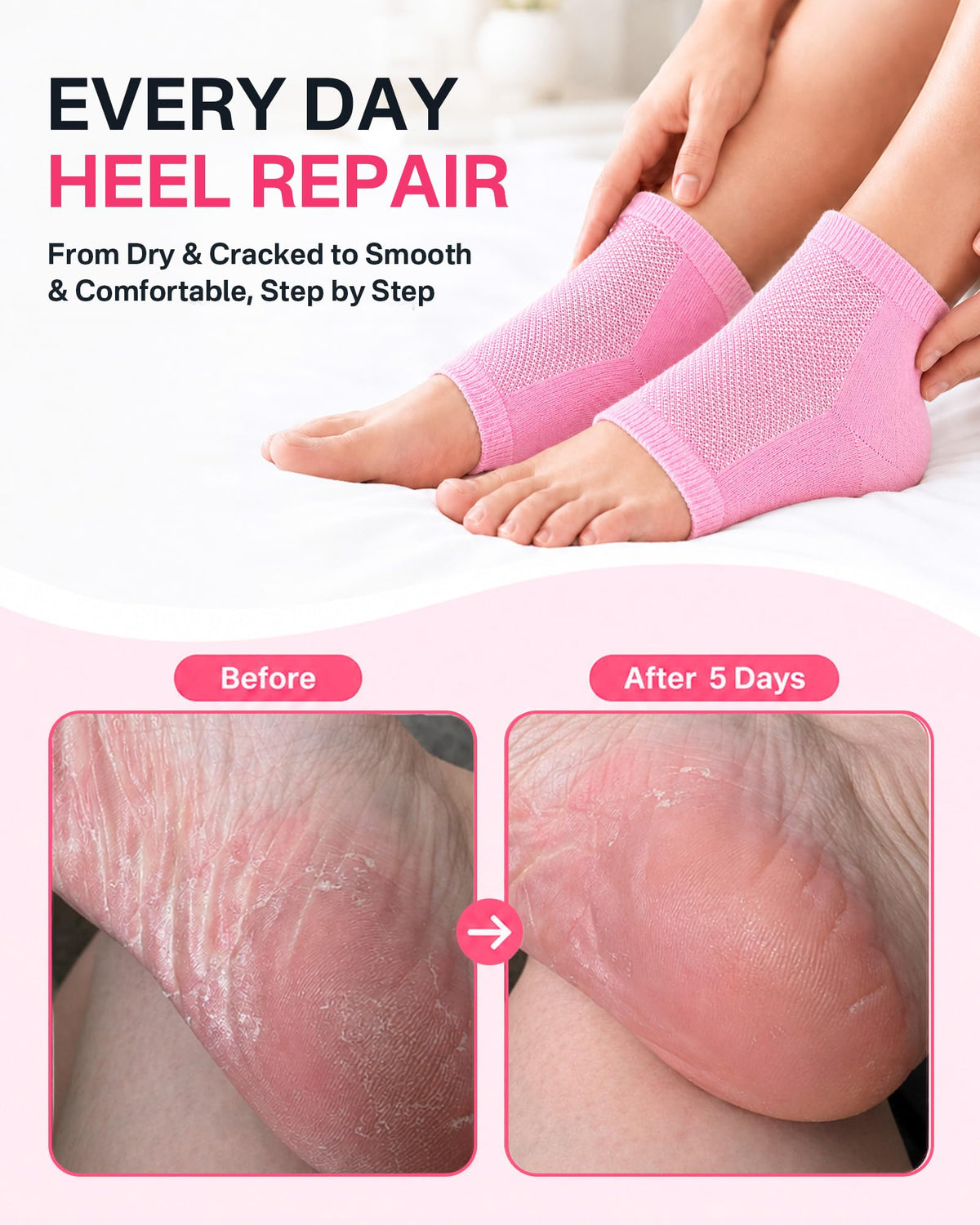 Side view of Originbuty Moisturizing Socks with gel lining