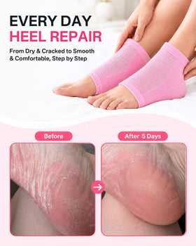 Side view of Originbuty Moisturizing Socks with gel lining