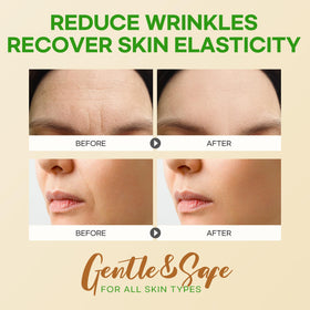 SILKDERMIS Forehead Wrinkle Patches displayed on a flat surface