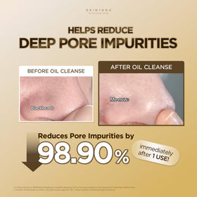 SKIN1004 Madagascar Centella Cleansing Oil application on skin