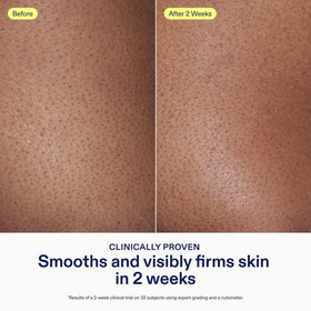 Skinfix AHA/BHA Renewing Body Cream packaging