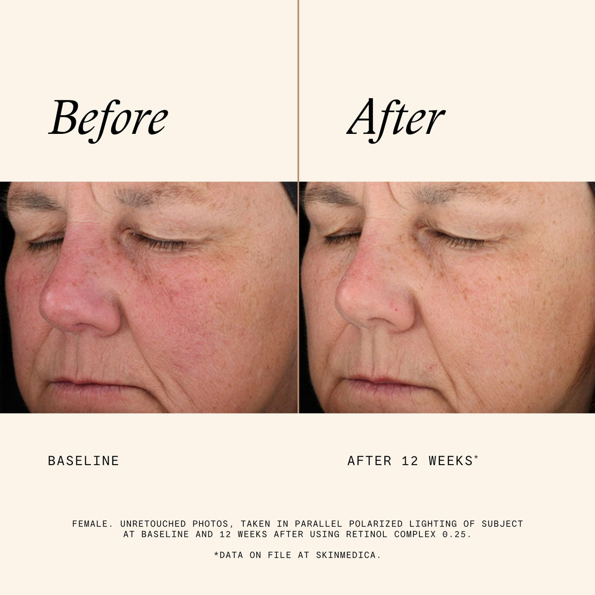 SkinMedica Retinol Serum 0.25 Complex packaging