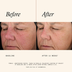 SkinMedica Retinol Serum 0.25 Complex packaging