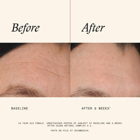 SkinMedica Retinol Serum 0.5 Complex close-up of pump