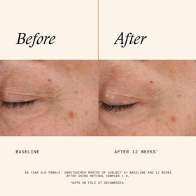 SkinMedica Retinol Serum 1.0 Complex ingredients list