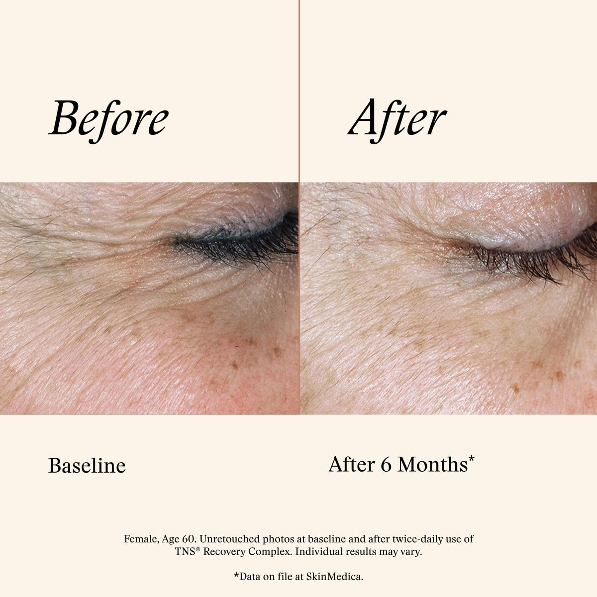 SkinMedica TNS Recovery Complex application on skin