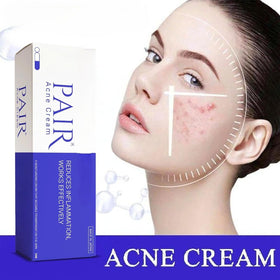 SKINSINS Acne Cream 14g in lifestyle setting