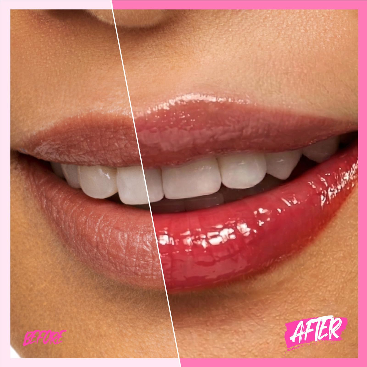 SKINTIFIC Brightening Lip Serum 11U Dusty Rose on a flat surface