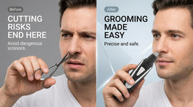 Sodynee Ear and Nose Hair Trimmer showing dual-edge blade