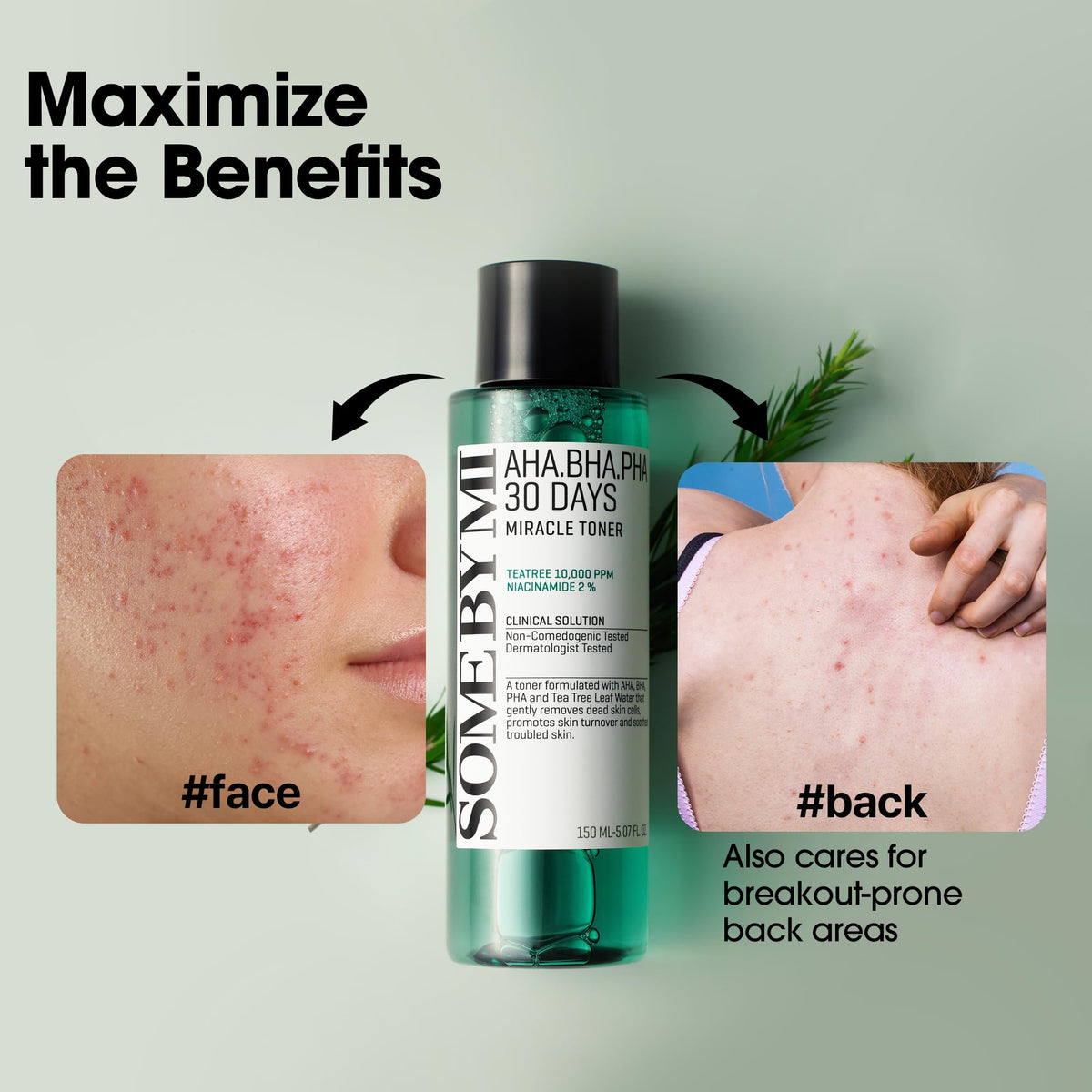 SOME BY MI AHA BHA PHA 30 Days Miracle Toner application on cotton pad