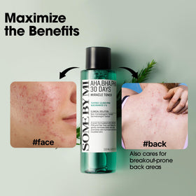 SOME BY MI AHA BHA PHA 30 Days Miracle Toner lifestyle scene