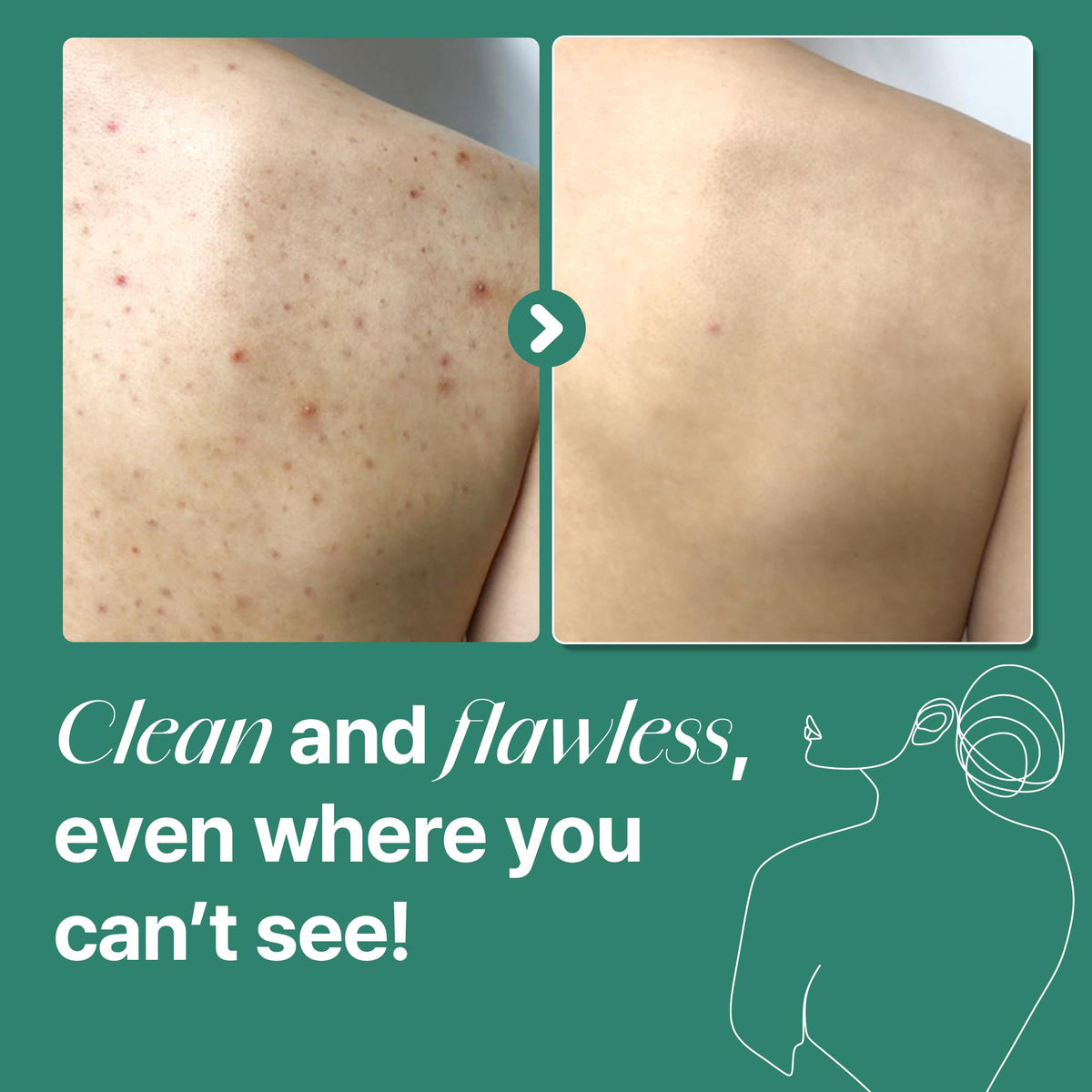 SOME BY MI body cleanser texture close-up
