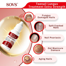 SOVS Toenail in a lifestyle setting