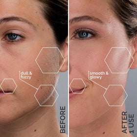 SPA SCIENCES SIMA Dermaplane Razor in use on skin