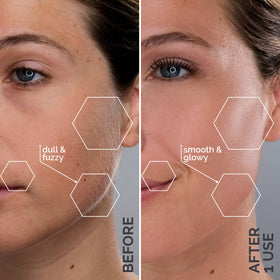 SPA SCIENCES SIMA Dermaplane Razor with dermaplaning blades