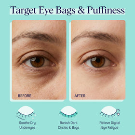 SpaLife Cooling Cucumber Eye Pads in use on a person