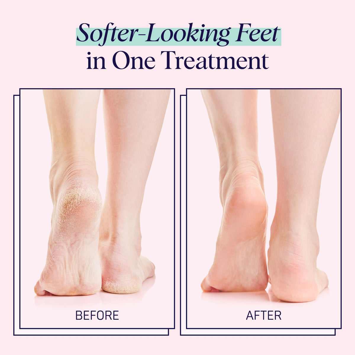 SpaLife Foot Mask Socks in use