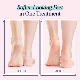 SpaLife Foot Mask Socks in use