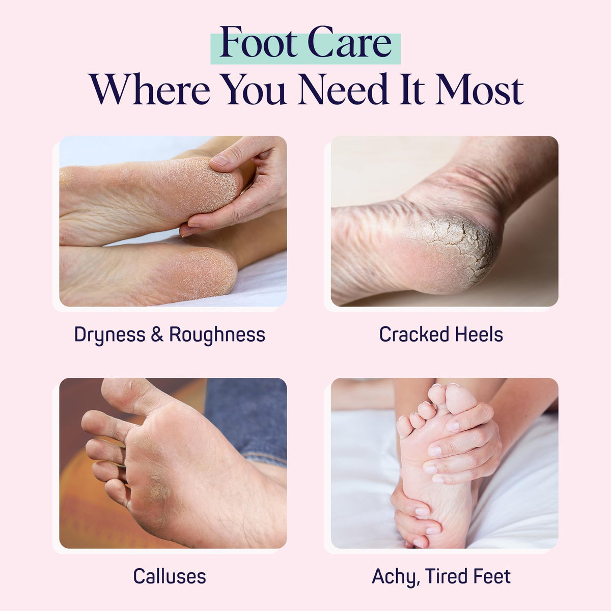 SpaLife Moisturizing Foot Sockies laid flat on a white background