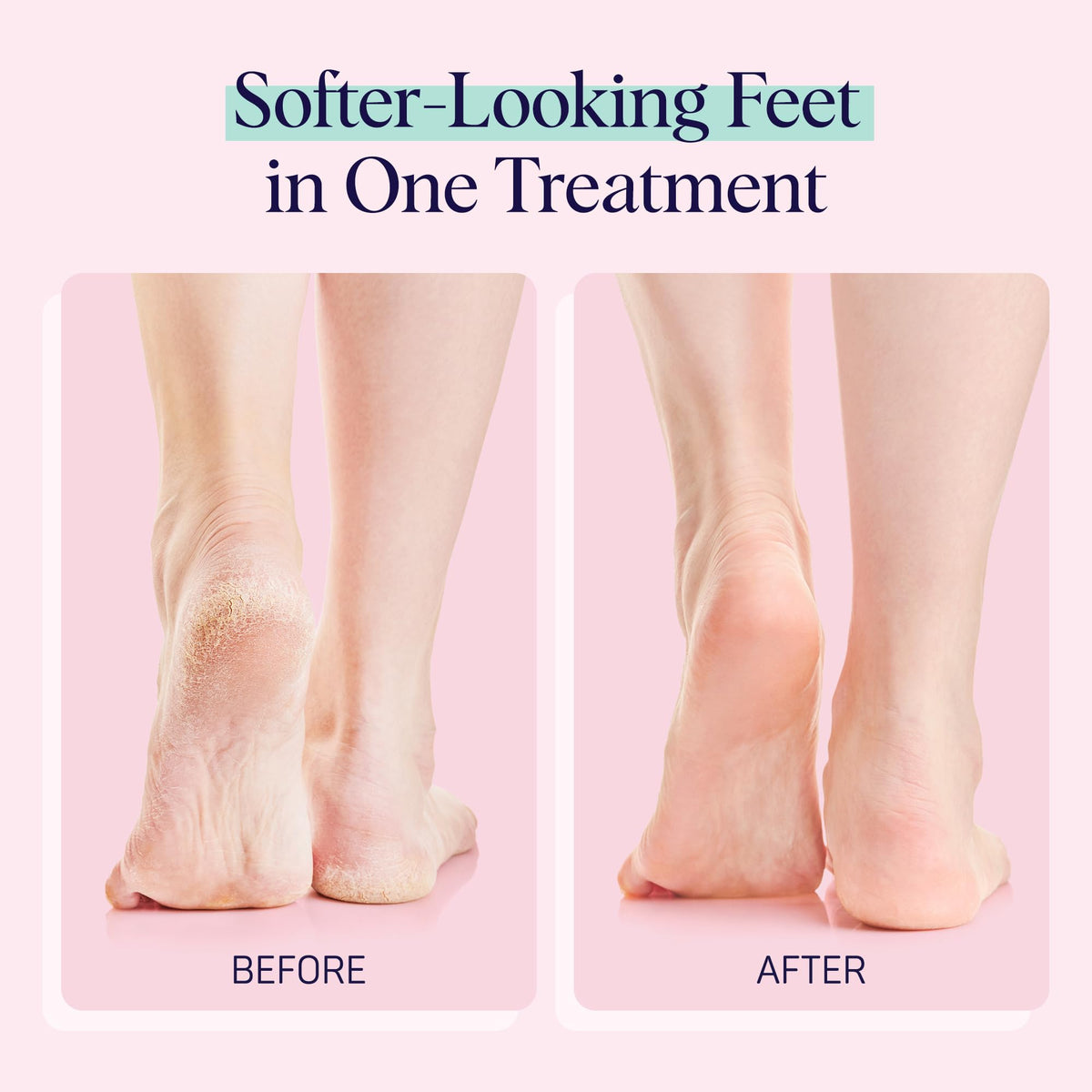 SpaLife Moisturizing Foot Sockies with ingredients displayed