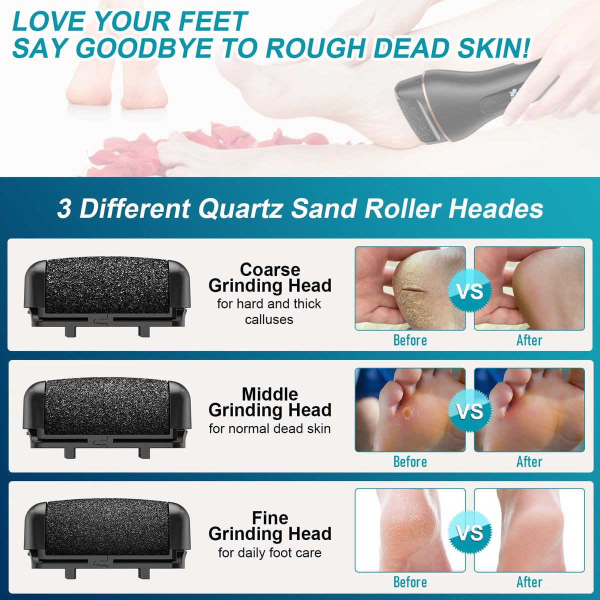 Spriak Callus Remover in use on a foot with dead skin