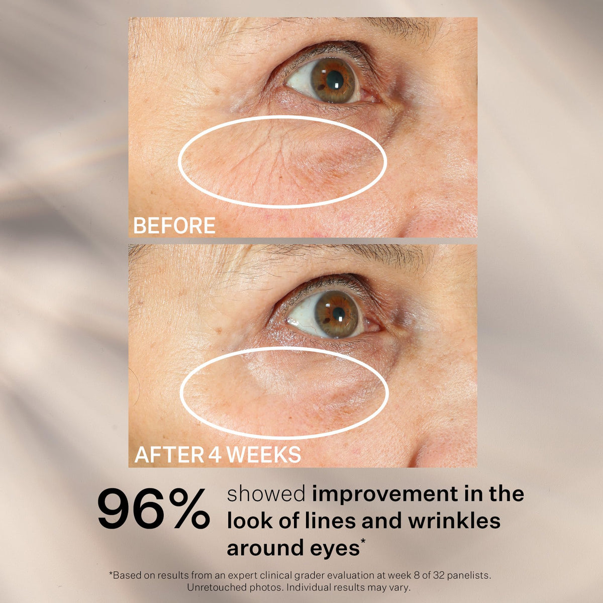 StriVectin Peptight® Eye Serum 1 oz lifestyle shot