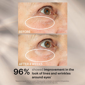 StriVectin Peptight® Eye Serum 1 oz lifestyle shot