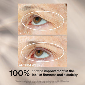 StriVectin Peptight® Eye Serum 1 oz on a bathroom counter