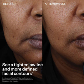 StriVectin Peptight Face Lift Firming Serum close-up of bottle