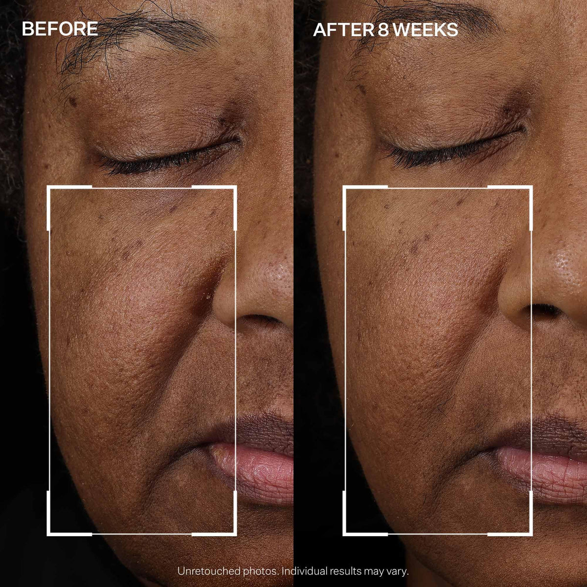 StriVectin Peptight Face Lift Firming Serum with skincare products