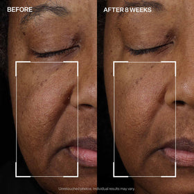 StriVectin Peptight Face Lift Firming Serum with skincare products