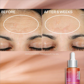 StriVectin Super-C Serum being applied to skin