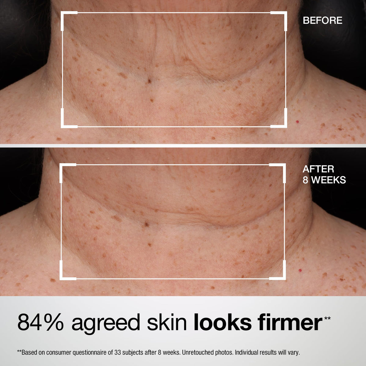 StriVectin TL Advanced Tightening Neck & Chest Lotion SPF 35 side view
