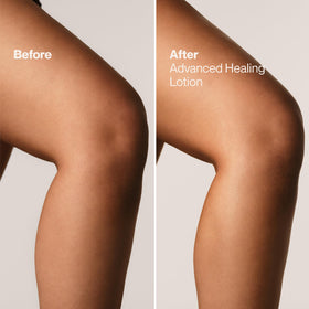 Suave Revitalizing Body Lotion with Vitamin E in a lifestyle setting