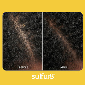 SULFUR8 Anti-Dandruff Conditioner 7.25 oz with cap open