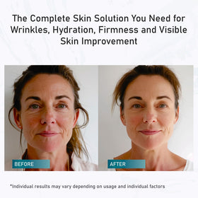 SUN COAST SCIENCES Total Package Serum group shot with skincare products