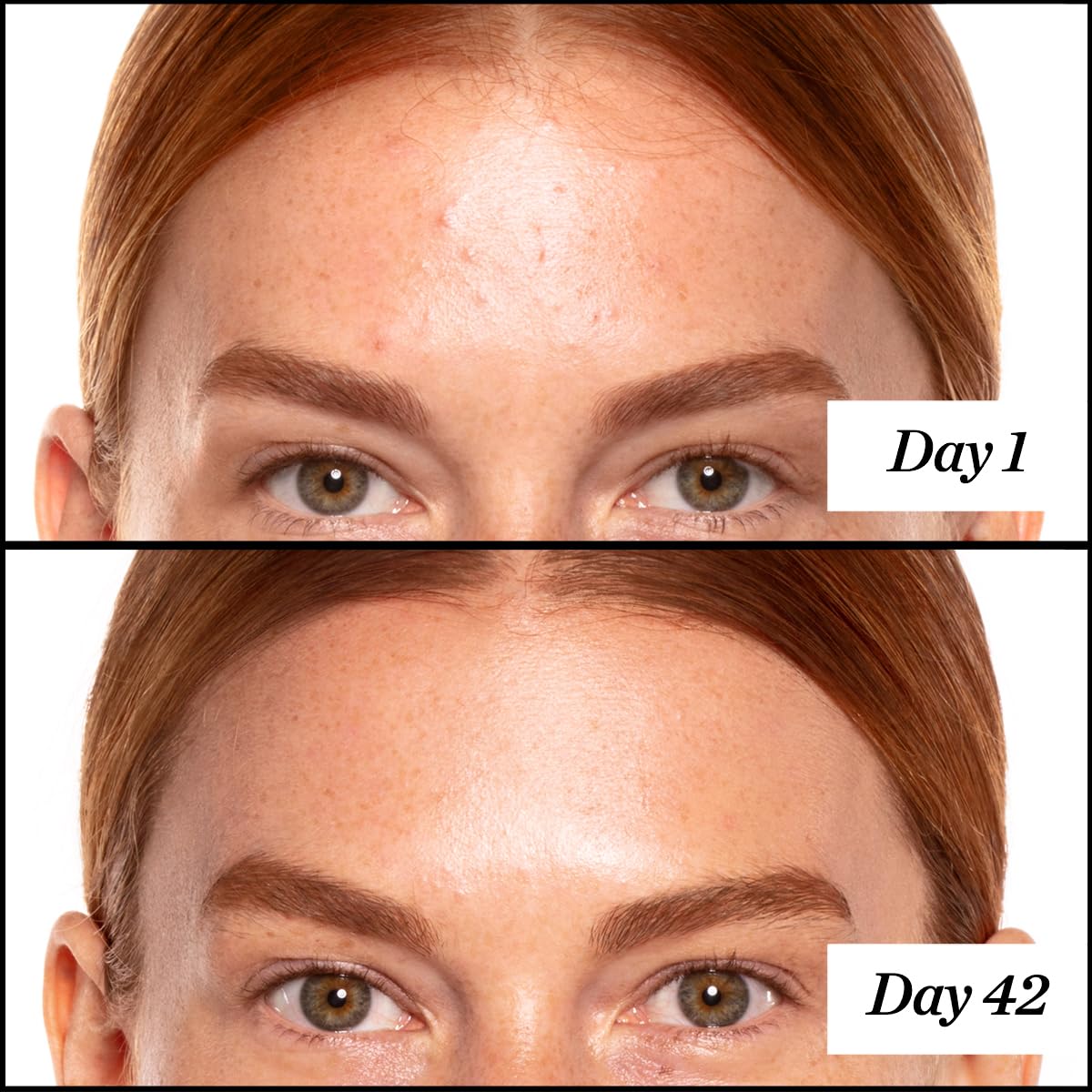 Sunday Riley A+ High-Dose Retinol Serum 1.0oz side view highlighting the dropper