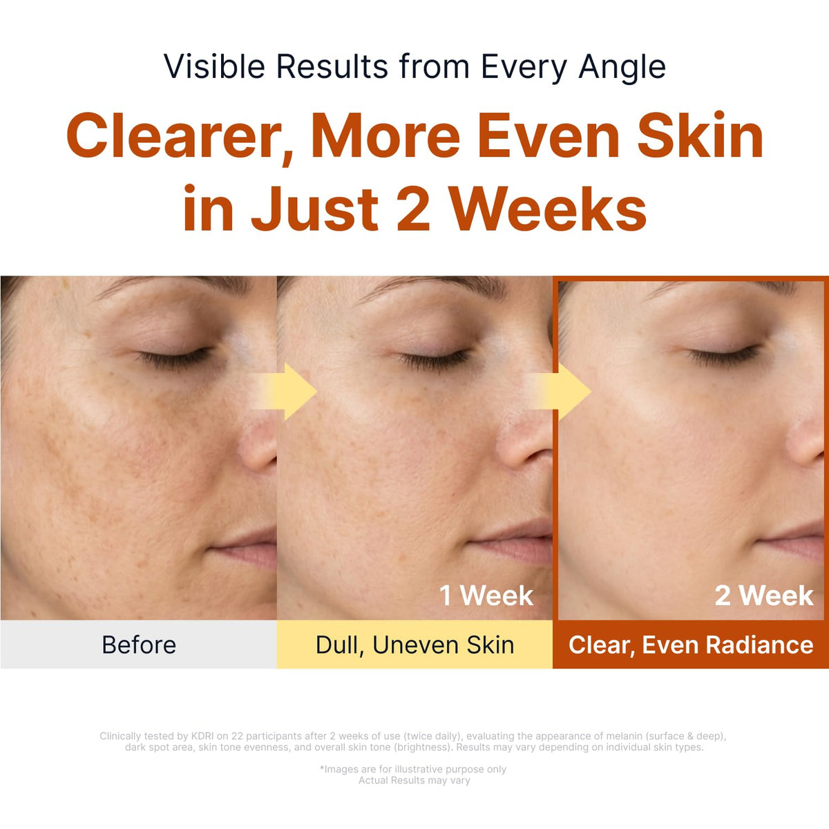SUNGBOON EDITOR Glow Intensive Kojic Acid Ampoule side view