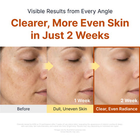 SUNGBOON EDITOR Glow Intensive Kojic Acid Ampoule side view