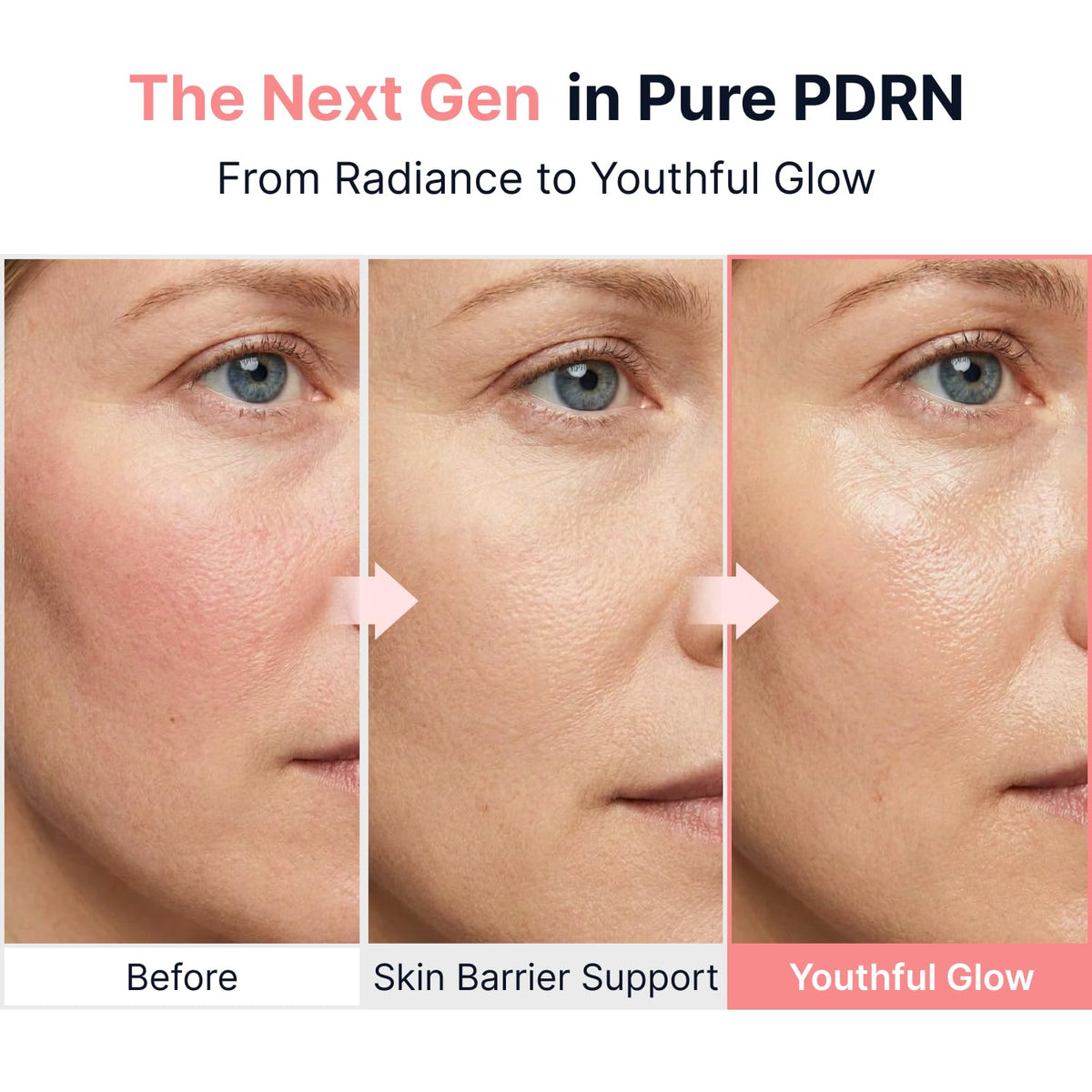 SUNGBOON EDITOR Glow Intensive PDRN Ampoule with dosage applicator