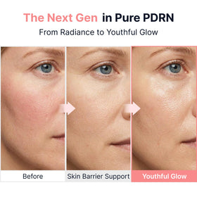 SUNGBOON EDITOR Glow Intensive PDRN Ampoule with dosage applicator