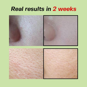 SUNGBOON EDITOR Green Tomato Pore Lifting Ampoule ingredients list