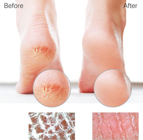 sunivaca Glass Foot File in hand demonstrating usage