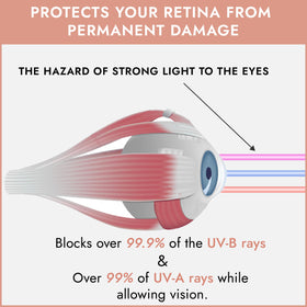 Super Sunnies goggles showing flexible eye cup design
