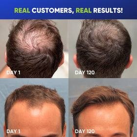 Svvimer Hair Growth Shampoo with rosemary and tea tree oil ingredients