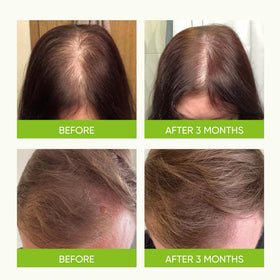 Svvimer Hair support Spray packaging side view