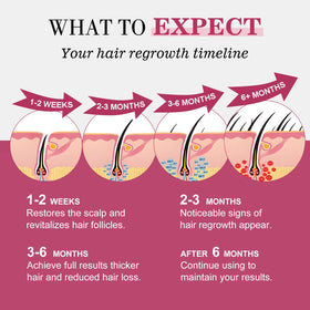TAGOQHIA 5% Minoxidil Hair Regrowth Spray on a bathroom shelf