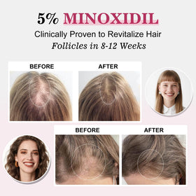 TAGOQHIA 5% Minoxidil Hair Regrowth Spray with Biotin