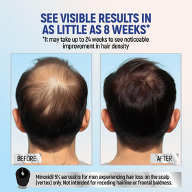 TARO Hair Regrowth foam application on hand